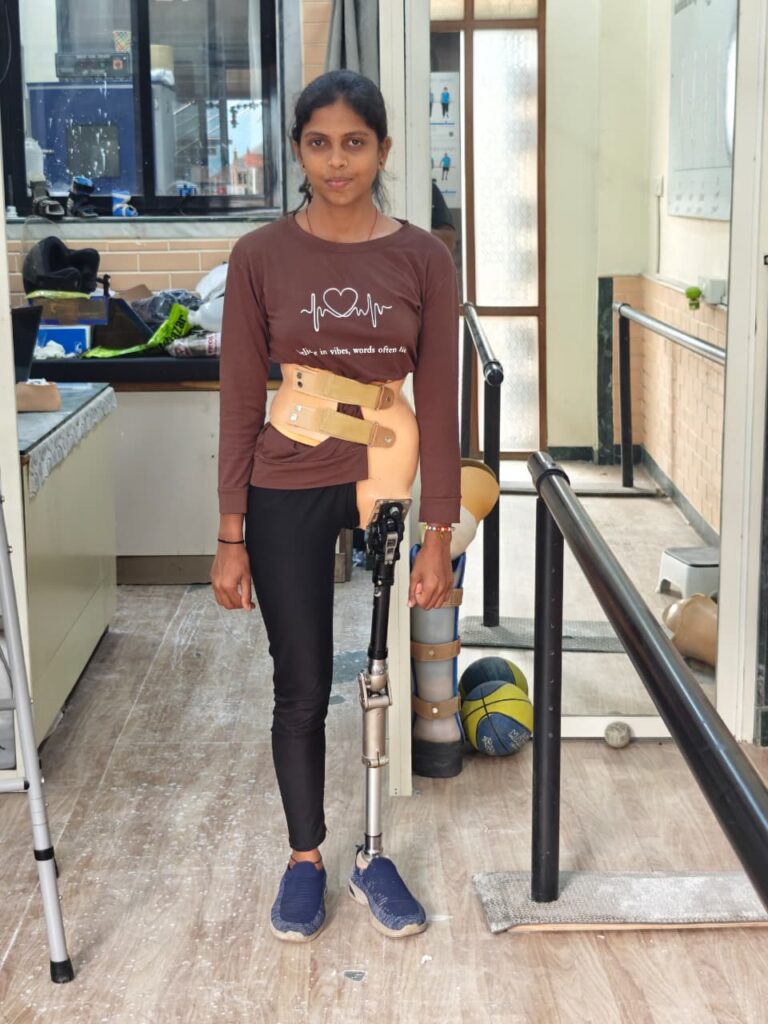 Chhatrapati Sambhajinagar Prosthetic Leg Student